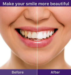 In Bucket Store 100% Original Teeth whitening Purple Serum
HiSmile "v34 Serum"